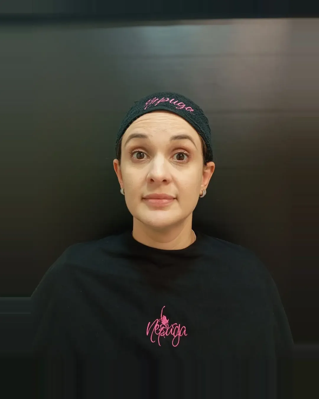 Antes — Toxina Botulínica — Testa
