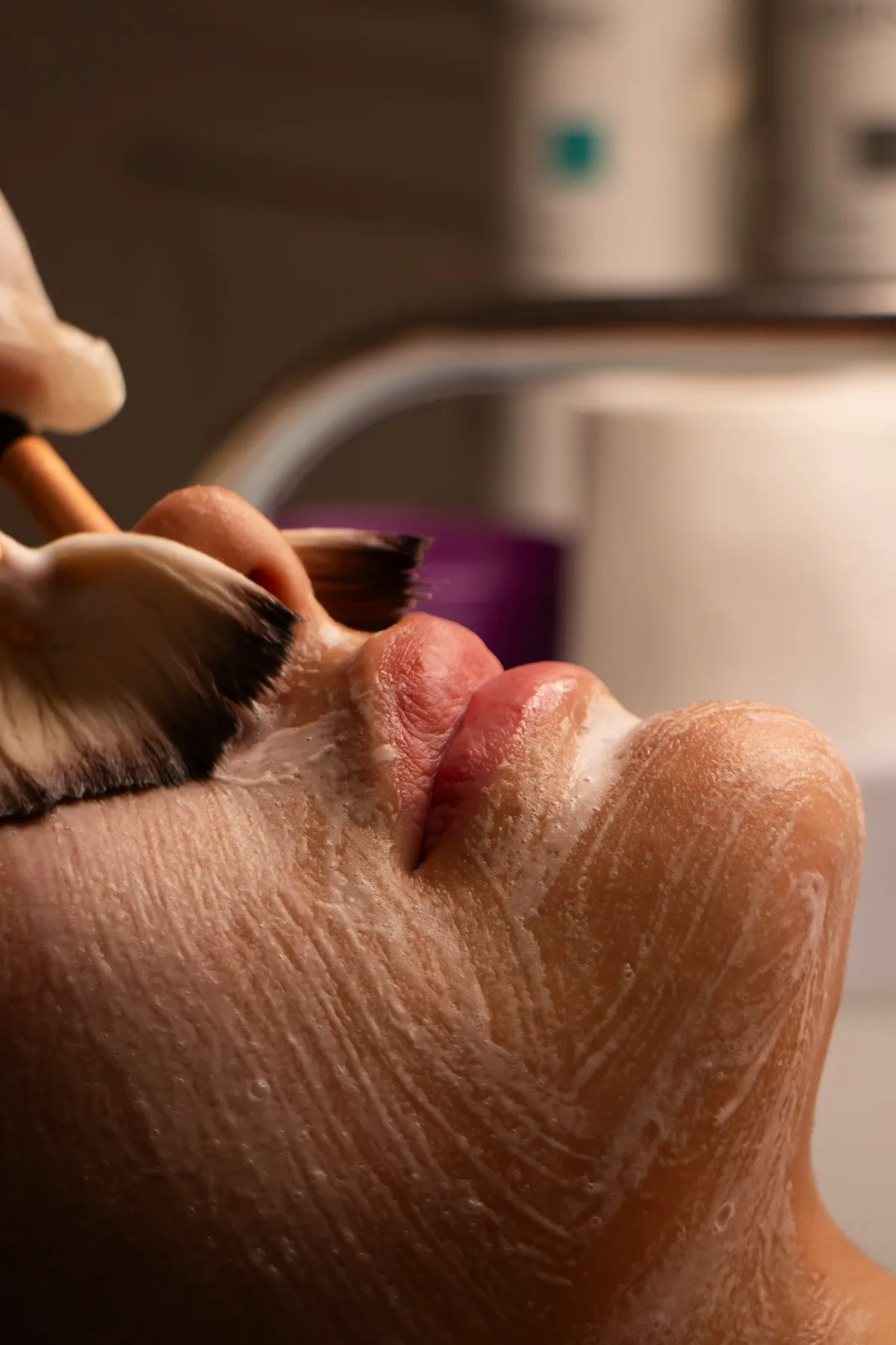 Peeling Químico